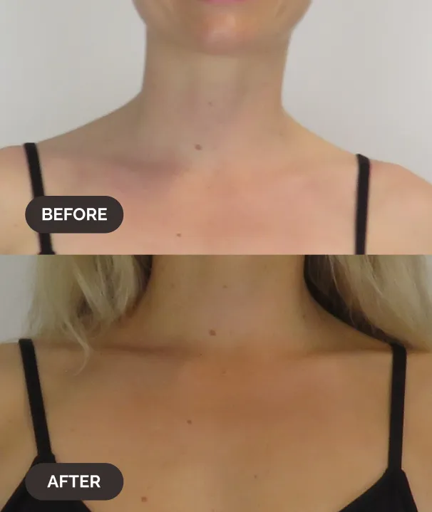 Self Tan Mist